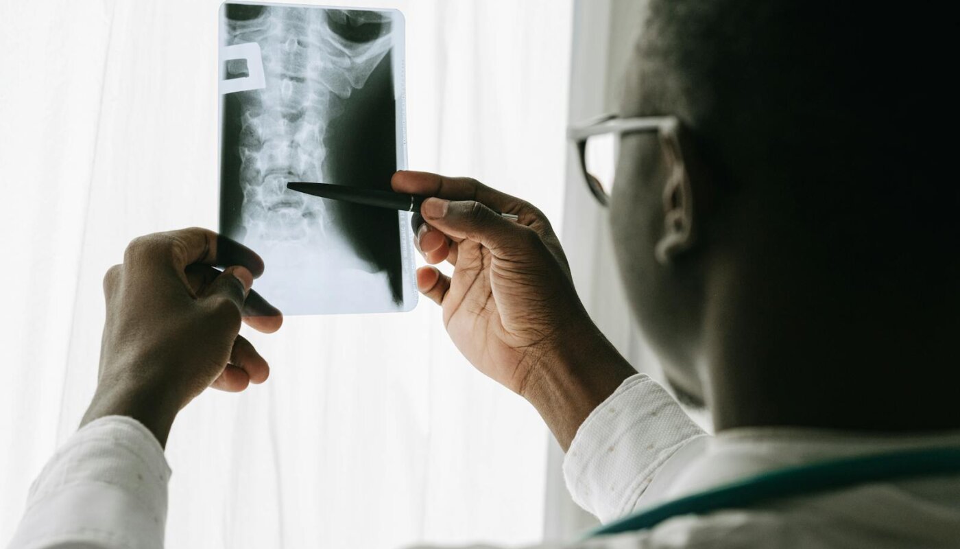 Close-up of a doctor examining a spine X-ray film with a pen in a hospital setting.