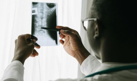 Close-up of a doctor examining a spine X-ray film with a pen in a hospital setting.