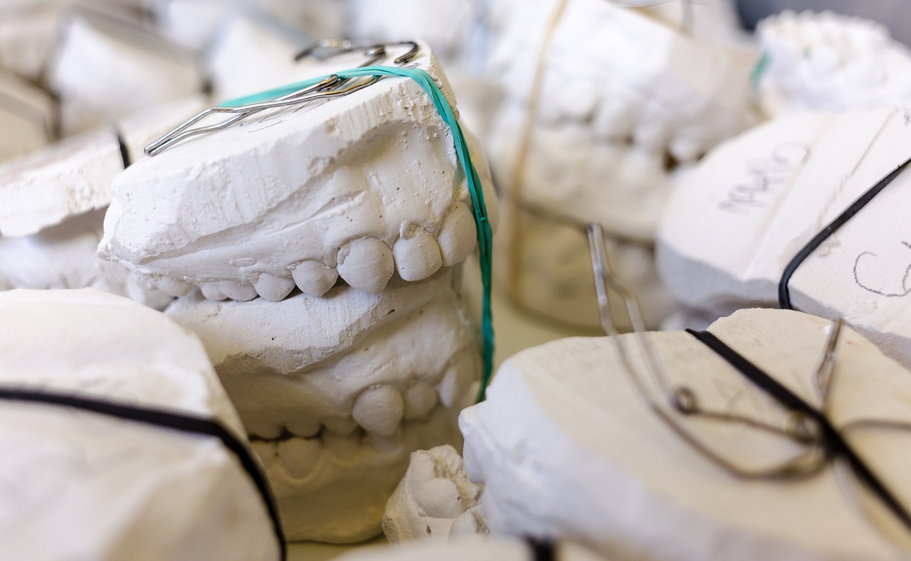 teeth, models, gypsum