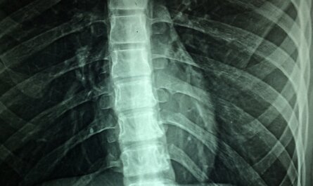 x-rays, hospital, disability