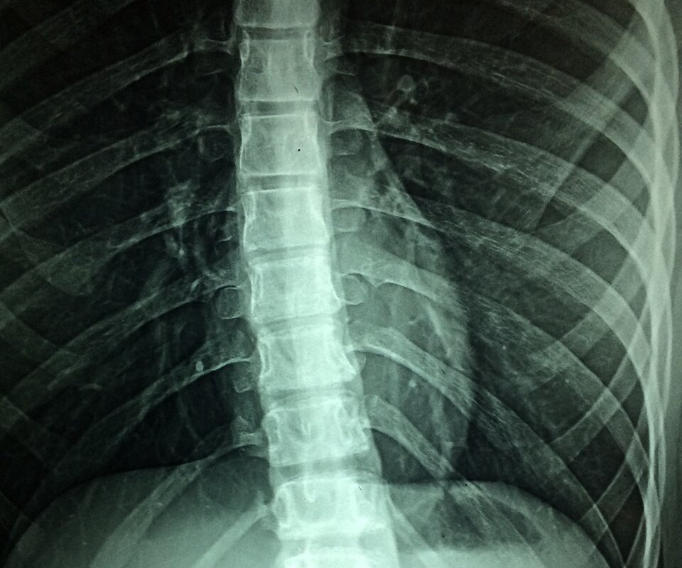 x-rays, hospital, disability