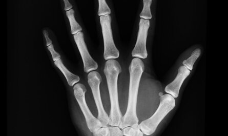 High-resolution X-ray capturing the bones of a human hand, displaying skeletal anatomy.