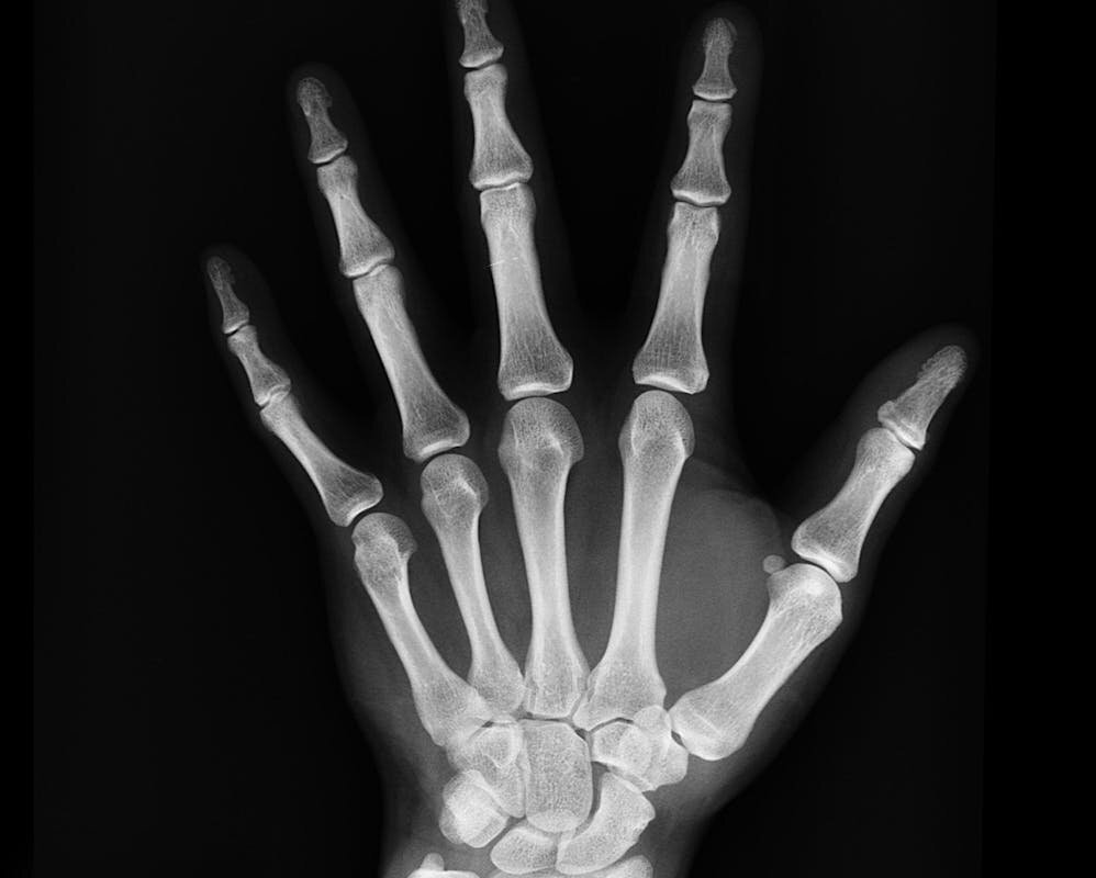 High-resolution X-ray capturing the bones of a human hand, displaying skeletal anatomy.