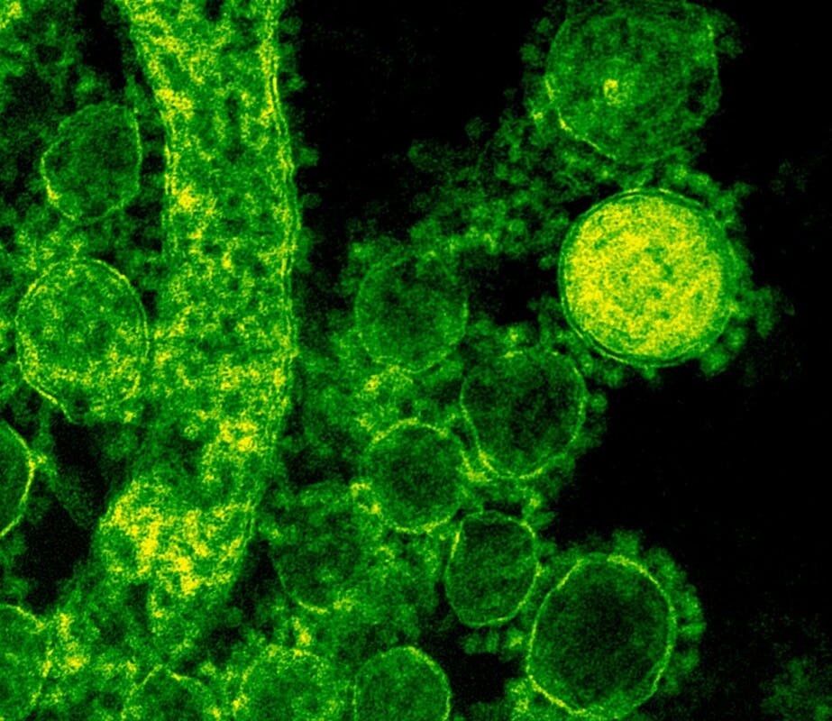 Green-tinted microscopic image of coronavirus particles illustrating viral structures.