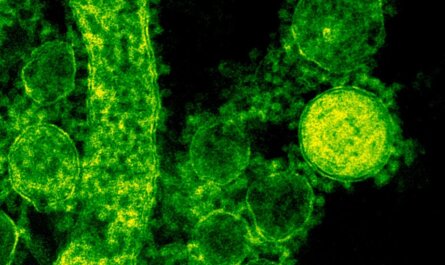 Green-tinted microscopic image of coronavirus particles illustrating viral structures.